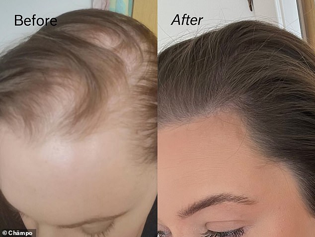 In both user and consumer testing, the serum has shown great success in stimulating hair follicles to regenerate growth and leave hair thicker and more voluminous.